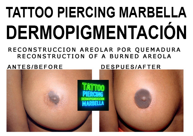100-14 copia