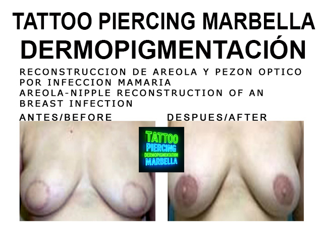 100-15 copia